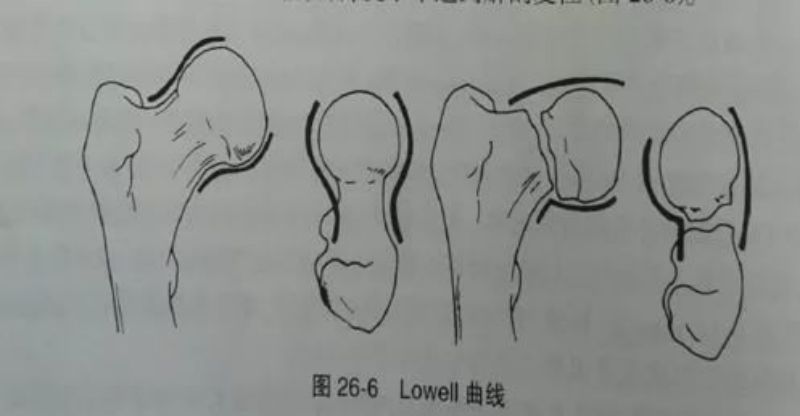 ஏசிவிஎஸ்டி (2)