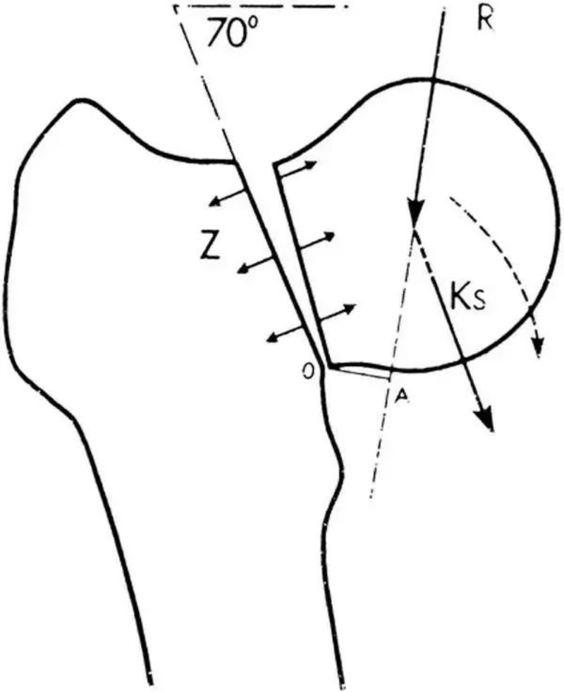 አቪኤስዲ (3)