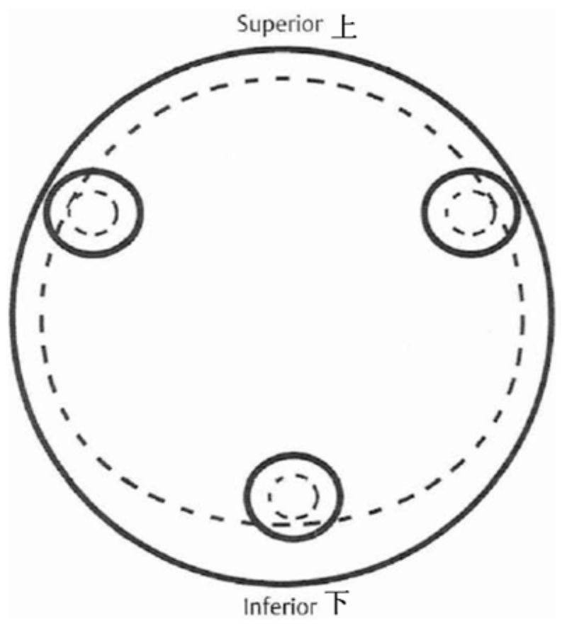 ஏசிவிஎஸ்டி (4)