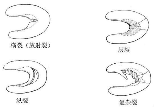 自闭症谱系障碍 (4)